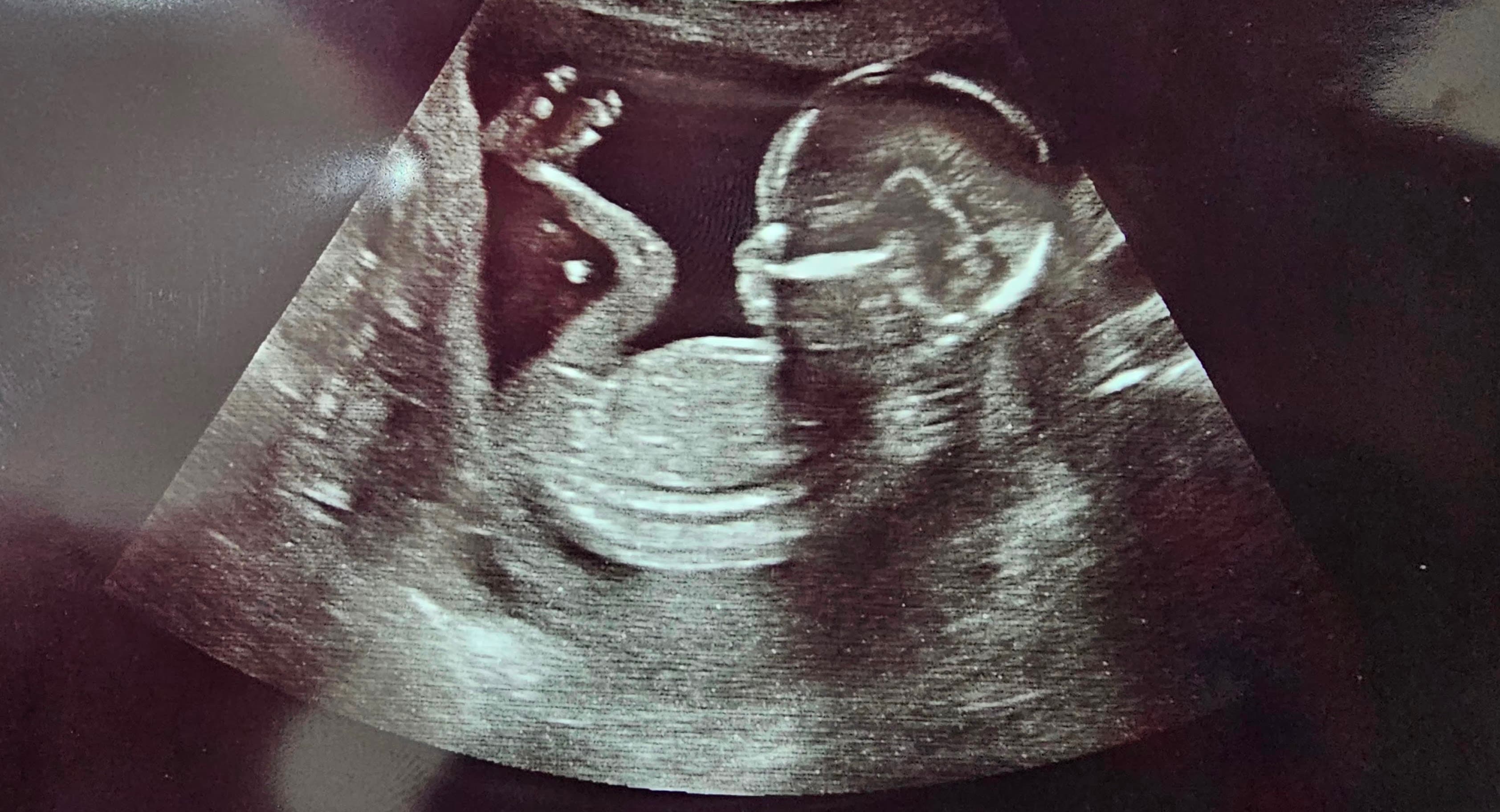 유하와의 첫 만남